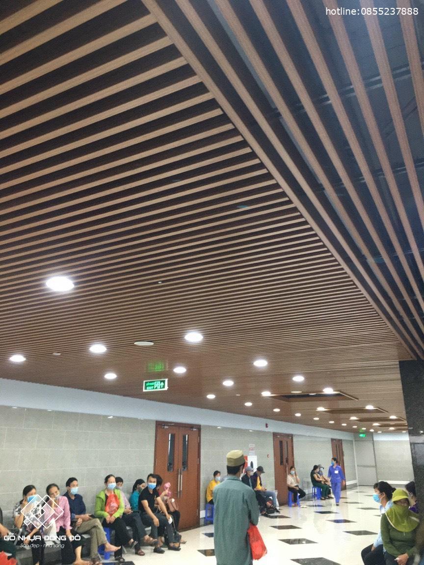 Lam Treo Tường - Trần HG10040 Walnut - Lam Gỗ Nhựa Bền, Đẹp 2 Lam Treo Tường - Trần Hg10040 Walnut - Lam Gỗ Nhựa Bền, Đẹp Ốp Trần Thực Tế